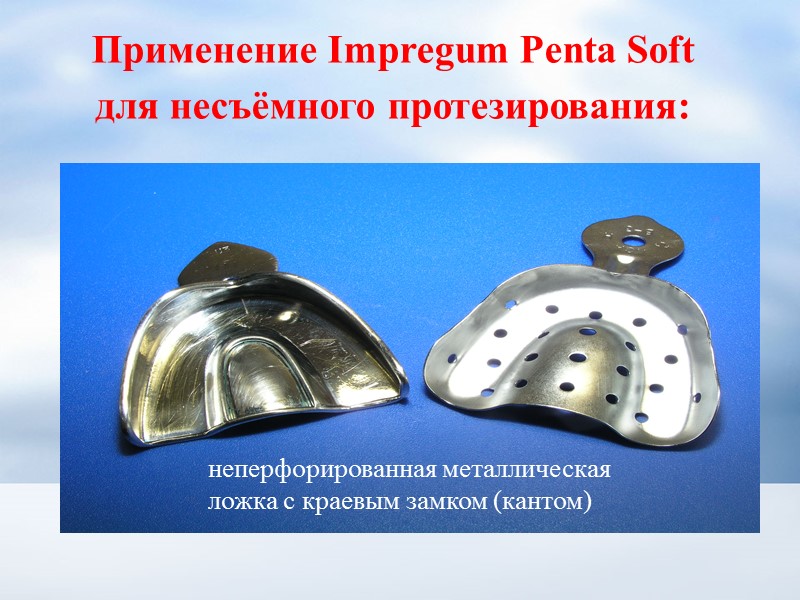 Применение Impregum Penta Soft для несъёмного протезирования:  неперфорированная металлическая ложка с краевым замком